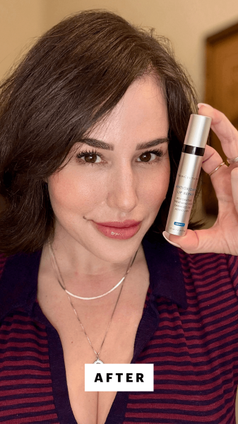 Robin after applying the SkinCeuticals Antioxidant Lip Repair
